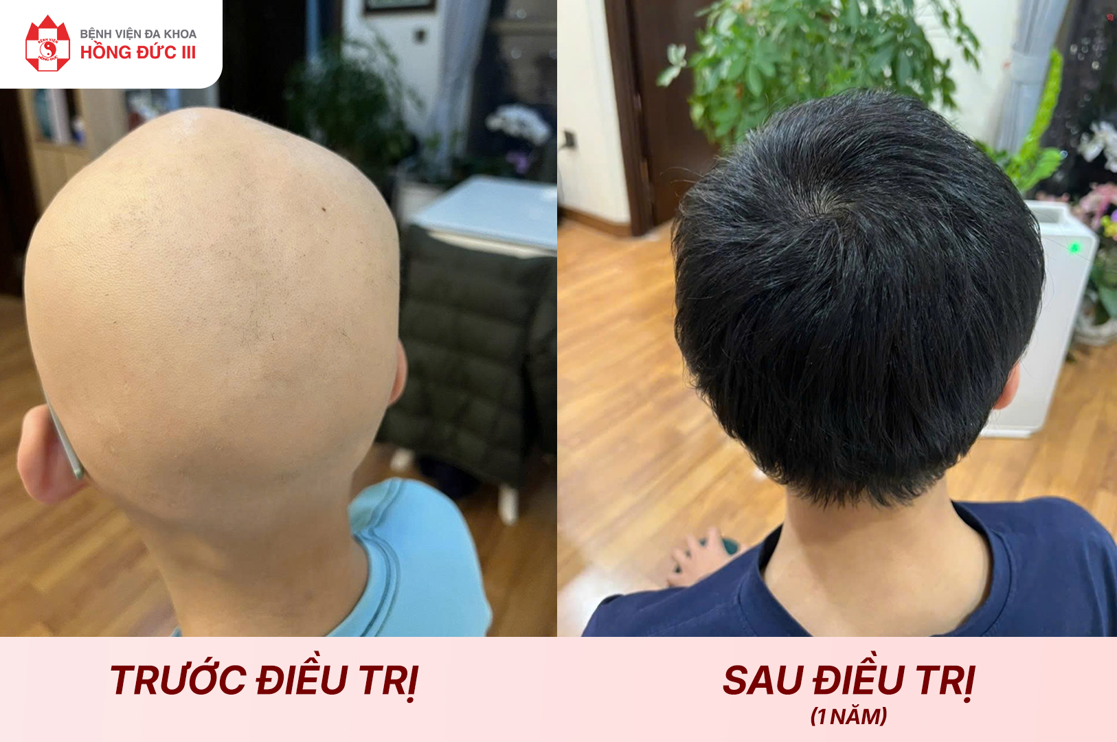 TS.BS. NGUYỄN ĐÌNH NHÂN và HÀNH TRÌNH  “HỒI SINH” NHỮNG PHẬN ĐỜI